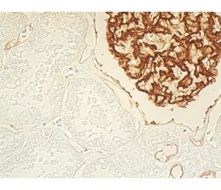 Podocalyxin-like 1 Antibody (3D3) | SCBT - Santa Cruz