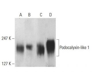 Podocalyxin-like 1 Antibody (3D3) - Western Blotting - Image 8610 