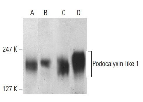 podocalyxin-like-1-antibody-