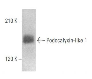 Podocalyxin-like 1 Antibody (3D3) | SCBT - Santa Cruz