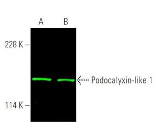 Podocalyxin-like 1 Antibody (3D3) | SCBT - Santa Cruz