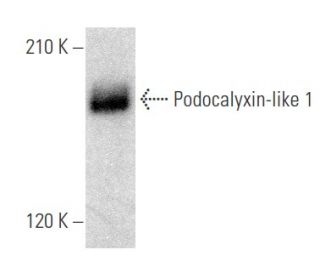 Podocalyxin-like 1 Antibody (4F10) - Western Blotting - Image 354059 