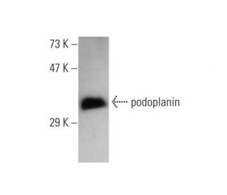 podoplanin Antibody (18H5) - Western Blotting - Image 145534