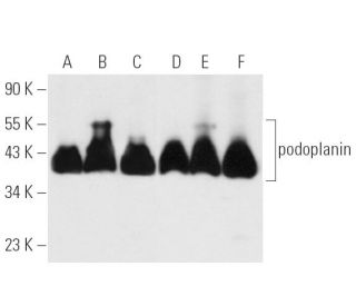 podoplanin Antibody (8.1.1) - Western Blotting - Image 13985 