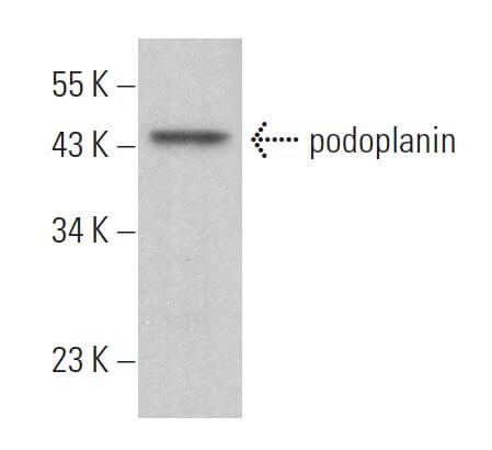 割引価格 podoplanin Biotechnology Cruz Santa - SCBT | (B-11) Antibody その他