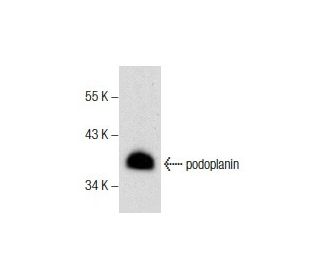 podoplanin Antibody (E-1) - Western Blotting - Image 157850 