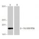Pol I/II/III RPB8 Antibody (SP-75) - Western Blotting - Image 65036