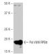 Pol I/II/III RPB8 Antibody (SP-75) - Western Blotting - Image 65038 