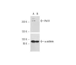Pol II siRNA (h): sc-36290. Western blot analysis of Pol II expression in non-transfected control (A) and Pol II siRNA tra 