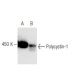 Polycystin-1 Antibody (7E12) - Western Blotting - Image 67392 
