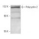This polyclonal antibody has been discontinued. See our recommended <a href="polycystin-2-antibody-yce2">Polycystin-2 (YCE2)</a> monoclonal antibody (sample data shown). western blotting image from recommended Polycystin-2 (YCE2) monoclonal antibody replacement. Image 11975
