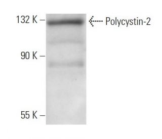 western blotting image from recommended Polycystin-2 (YCE2) monoclonal antibody replacement. Image 11975