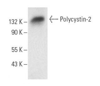 Polycystin-2 Antibody (D-3) - Western Blotting - Image 8505