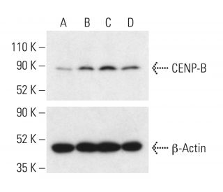 Polyinosinic acid - polycytidylic acid sodium salt, double stranded: sc-204854. Western blot analysis of CENP-B expression