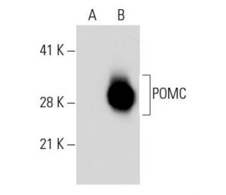 ACTH Antibody (B427) - Western Blotting - Image 39393