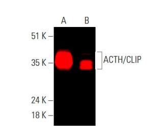 ACTH/CLIP Antibody (F-3) - Western Blotting - Image 378846