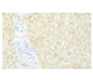 POMGnT1 Antibody (JD.23) - Immunohistochemistry - Image 53959
