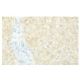 POMGnT1 Antibody (JD.23) - Immunohistochemistry - Image 53959
