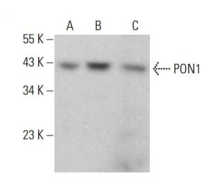 PON1 Antibody (4G8D3) - Western Blotting - Image 382680SAM Transcription Activation: SAM system utilizing dCas9-VP64, MS2-P65-HSF1, and sgRNA for precise gene transcription activation.