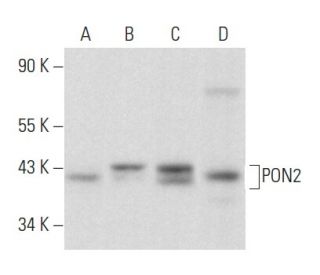 PON2 Antibody (C-5) - Western Blotting - Image 358025SAM Transcription Activation: SAM system utilizing dCas9-VP64, MS2-P65-HSF1, and sgRNA for precise gene transcription activation.