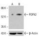 Anticorps POPX2 (G-10): sc-393806. Analyse par Western blot de l'expression de POPX2 dans des lysats cellulaires complets K-562 non traités (A) et traités chimiquement (B). β-Actine (C4): sc-47778 utilisé comme contrôle de chargement. Réactif de détection utilisé: m-IgG Fc BP-HRP: sc-525409. POPX2 Antibody (G-10) - Western Blotting - Image 415311