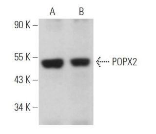 POPX2 Antibody (B-11) - Western Blotting - Image 367723 