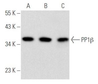 PP1β Antibody (D-11) - Western Blotting - Image 355790