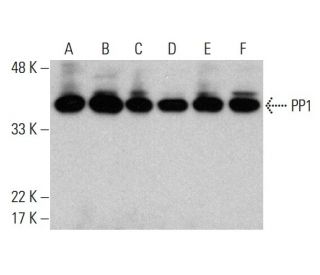 western blotting image from recommended PP1 (E-9) monoclonal antibody replacement. Image 376868