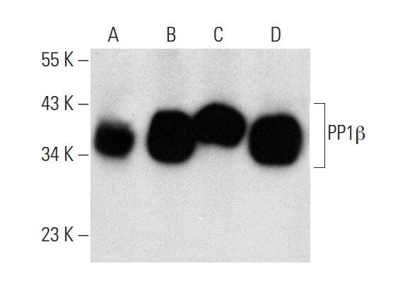 PP1 Antibody A 6 SCBT Santa Cruz Biotechnology