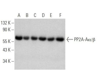 PP2A-Aα/β Antibody (H-11) - Western Blotting - Image 370483