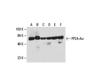 western blotting image from recommended PP2A-Aα (6G3) monoclonal antibody replacement. Image 19125