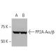 PP2A-Aα/β Antibody (4C10) - Western Blotting - Image 38329
