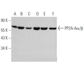 PP2A-A&alpha;/&beta; Antibody (4C10) - Western Blotting - Image 368602 