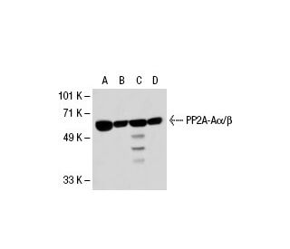 PP2A-A&alpha;/&beta; Antibody (A-5) - Western Blotting - Image 30302 