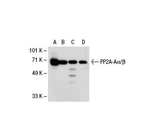 PP2A-A&alpha;/&beta; Antibody (H-11) - Western Blotting - Image 30301 