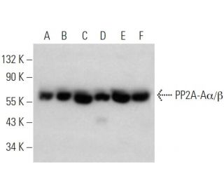 PP2A-A&alpha;/&beta; Antibody (H-2) - Western Blotting - Image 370486 
