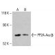 PP2A-Aα/β Antibody (H-2) - Western Blotting - Image 414440