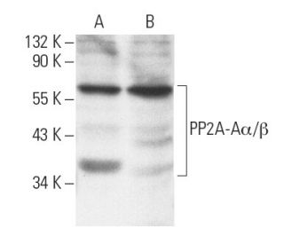 western blotting image from recommended PP2A-A&alpha;/&beta; (4G7) monoclonal antibody replacement. Image 2306