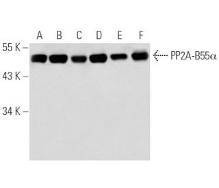 PP2A-B55-&alpha; Antibody (2G9) - Western Blotting - Image 19154 