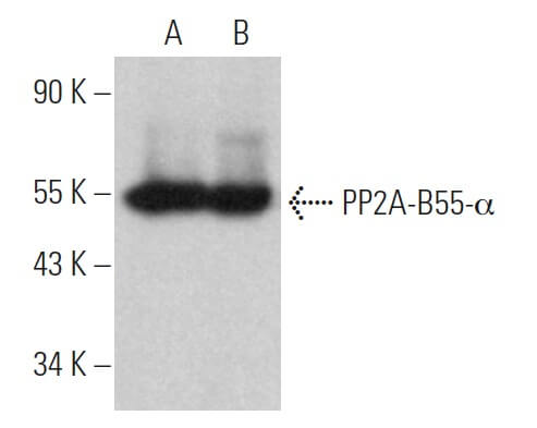 PP2A-B55-α Antibody (2G9) | SCBT - Santa Cruz Biotechnology