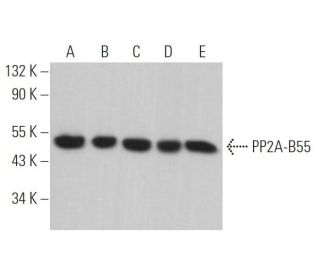 western blotting image from recommended PP2A-B55 (D-10) monoclonal antibody replacement. Image 363475
