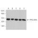 western blotting image from recommended PP2A-B55 (D-10) monoclonal antibody replacement. Image 363475
