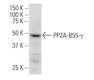 PP2A-B55-&gamma; Antibody (OS-5) - Western Blotting - Image 33790