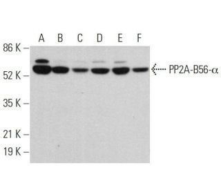 western blotting image from recommended PP2A-B56-α (F-10) monoclonal antibody replacement. Image 359710