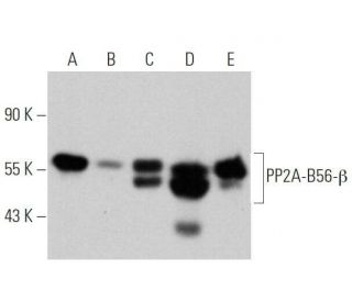 PP2A-B56-Î2 Antibody (C-19): sc-6117