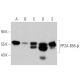 Dieser polyklonale Antikörper wird nicht mehr hergestellt. Wir empfehlen Ihnen unseren <a href="pp2a-b56-beta-antibody-e-6">PP2A-B56-β (E-6)</a> monoklonalen Antikörper (Beispielsdaten werden angezeigt). western blotting image from recommended PP2A-B56-β (E-6) monoclonal antibody replacement. Image 356258