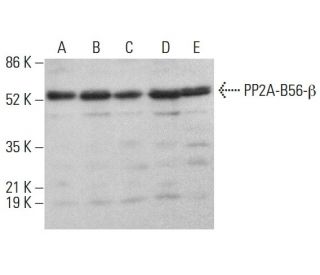 PP2A-B56-&beta; Antibody (D-10) - Western Blotting - Image 383786 