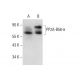 PP2A-B56-δ Antibody (H-11) - Western Blotting - Image 132750 