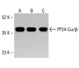 PP2A-Cα/β Antibody (7A6) - Western Blotting - Image 413374