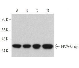 PP2A-Cα/β Antibody (0.T.118) - Western Blotting - Image 370858